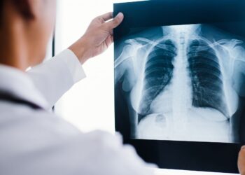 Understanding Your Body Better Through DEXA Insights